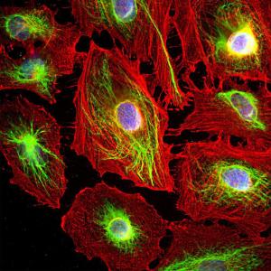 Immunofluorescence analysis of HeLa cells co-stained with Anti-Vimentin Antibody (1:5000/green) and Anti-Actin Antibody (A85388/1:500/red). Blue is DAPI staining of nuclear DNA. The Anti-Vimentin Antibody stains the 10nm or intermediate filament network of the cytoskeleton.