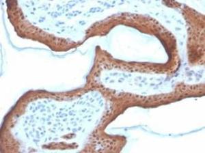 Immunohistochemical analysis of formalin-fixed, paraffin-embedded human skin tissue using Anti-Maspin Antibody [SERPINB5/4972]