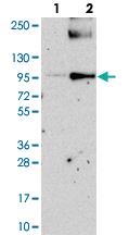 Anti-PIGN Rabbit Polyclonal Antibody