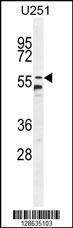 Anti-CCDC9 Rabbit Polyclonal Antibody (FITC (Fluorescein Isothiocyanate))