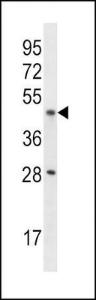 Anti-IL9R Rabbit Polyclonal Antibody (APC (Allophycocyanin))