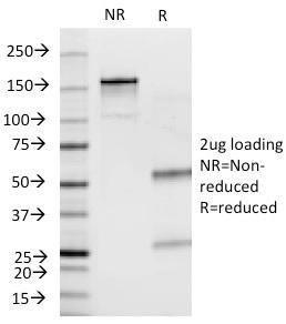 Anti-Insulin antibody