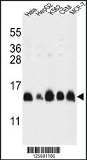 Anti-HIST1H2AL Rabbit Polyclonal Antibody