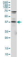 Anti-PAX5 Mouse Monoclonal Antibody [clone: 8F9]