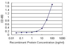 Anti-ARHGDIA Polyclonal Antibody Pair