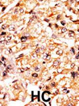 Anti-RBL1 Rabbit Polyclonal Antibody (HRP (Horseradish Peroxidase))