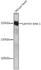 Anti-Laminin beta 1 Rabbit Monoclonal Antibody [clone: ARC0985]