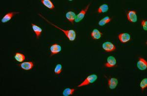 View of HeLa cells stained with Anti-Vimentin Antibody (red) and Anti-La min A/C Antibody (A85444/green). DNA is blue. Anti-Vimentin Antibody reveals strong cytoplasmic intermediate filament staining, while Anti-La min A/C Antibody reveals strong nuclear la mina staining