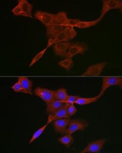 Anti-JAK1 antibody