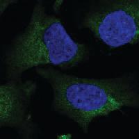 Anti-NIT2 Rabbit Polyclonal Antibody