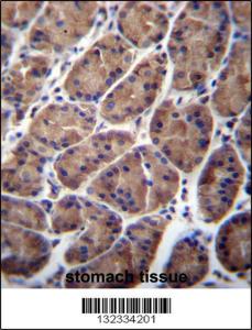 Anti-PFDN5 Rabbit Polyclonal Antibody (HRP (Horseradish Peroxidase))