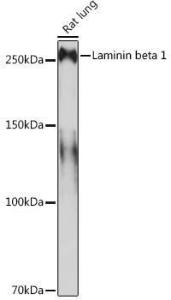 Anti-Laminin beta 1 Rabbit Monoclonal Antibody [clone: ARC0985]