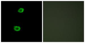 Immunofluorescence analysis of HepG2 cells using Anti-LMTK2 Antibody. The right hand panel represents a negative control, where the antibody was pre-incubated with the immunising peptide