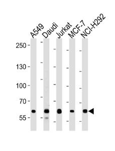 Anti-FOXP1 Rabbit Polyclonal Antibody (HRP (Horseradish Peroxidase))