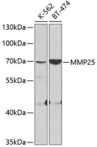 Western blot analysis of extracts of various cell lines, using Anti-MMP25 Antibody (A11602) at 1:400 dilution