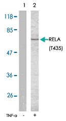 Anti-RELA Rabbit Polyclonal Antibody