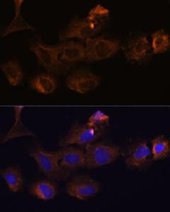 Immunofluorescence analysis of C6 cells using Anti-MMP25 Antibody (A11602) at a dilution of 1:100. DAPI was used to stain the cell nuclei (blue)