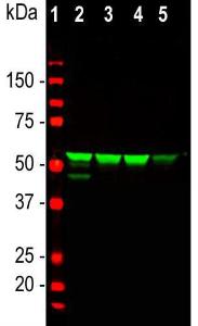 Western blot analysis of whole cell lysates using Anti-Vimentin Antibody (1:5000/green): [1] protein standard (red), [2] HeLa, [3] SH-SY5Y, [4] HEK293, [5] NIH 3T3 cells. Strong band corresponds to vimentin protein with apparent SDS-PAGE molecular weight of 54 kDa