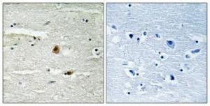 Immunohistochemical analysis of paraffin-embedded human brain using Anti-COPS1 Antibody 1:100 (4 °C overnight). The right hand panel represents a negative control, where the antibody was pre-incubated with the immunising peptide