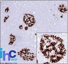 Anti-Insulin Mouse Monoclonal Antibody [clone: SPM531]