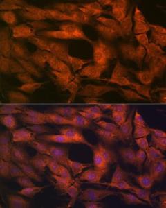 Anti-Laminin beta 1 Rabbit Monoclonal Antibody [clone: ARC0985]