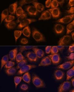 Immunofluorescence analysis of HeLa cells using Anti-MMP25 Antibody (A11602) at a dilution of 1:100. DAPI was used to stain the cell nuclei (blue)