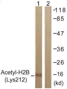 Western blot analysis of lysates from COS7 cells, treated with TSA 400 nM 24 h using Anti-Histone H2B (acetyl Lys12) Antibody. The right hand lane represents a negative control, where the Antibody is blocked by the immunising peptide