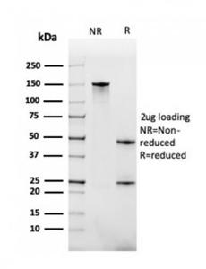 SDS-PAGE analysis of Anti-BAFF-R Antibody [BAFFR/1558] under non-reduced and reduced conditions; showing intact IgG and intact heavy and light chains, respectively. SDS-PAGE analysis confirms the integrity and purity of the antibody.