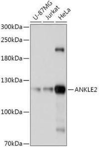 Western blot analysis of extracts of various cell lines, using Anti-ANKLE2 Antibody (A305517) at 1:1,000 dilution The secondary antibody was Goat Anti-Rabbit IgG H&L Antibody (HRP) at 1:10,000 dilution Lysates/proteins were present at 25 µg per lane