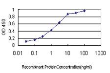 Anti-PAX5 Mouse Monoclonal Antibody [clone: 8F9]