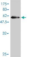 Anti-RABL2B Mouse Monoclonal Antibody [clone: 1B10]