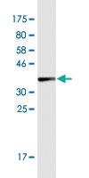 Anti-COL1A2 Mouse Monoclonal Antibody [clone: 7E11]