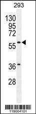 Anti-CPA2 Rabbit Polyclonal Antibody (AP (Alkaline Phosphatase))