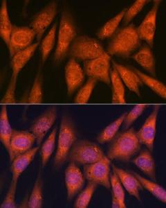 Anti-Laminin beta 1 Rabbit Monoclonal Antibody [clone: ARC0985]