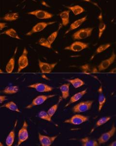 Immunofluorescence analysis of L929 cells using Anti-MMP25 Antibody (A11602) at a dilution of 1:100. DAPI was used to stain the cell nuclei (blue)