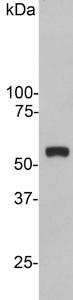 Western blot of crude extract of HeLa cells stained with Anti-Vimentin Antibody - showing a single strong clean band at 55 kDa