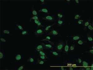 Anti-CMAS Mouse Monoclonal Antibody [clone: 5A2]