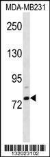 Anti-ELL2 Rabbit Polyclonal Antibody (HRP (Horseradish Peroxidase))