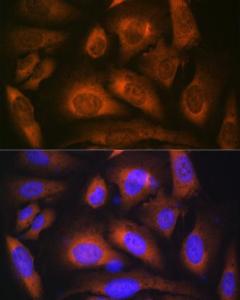 Anti-Laminin beta 1 Rabbit Monoclonal Antibody [clone: ARC0985]