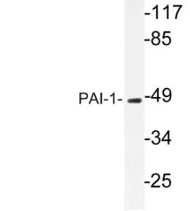 Antibody anti-PAI-1 100 µg