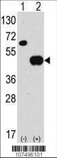 Anti-ATG4B Rabbit Polyclonal Antibody