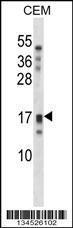 Anti-KLK15 Rabbit Polyclonal Antibody (AP (Alkaline Phosphatase))