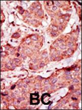 Anti-PFKP Rabbit Polyclonal Antibody