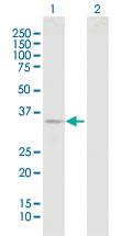 Anti-DCUN1D1 Rabbit Polyclonal Antibody