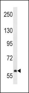 Anti-TEC Rabbit Polyclonal Antibody (AP (Alkaline Phosphatase))