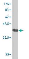 Anti-TSPAN7 Mouse Polyclonal Antibody