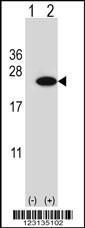 Anti-CIRBP Rabbit Polyclonal Antibody (APC (Allophycocyanin))