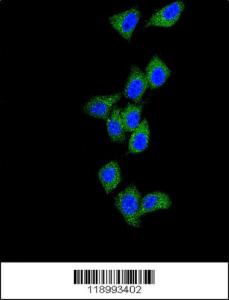 Anti-CASP8 Rabbit polyclonal antibody