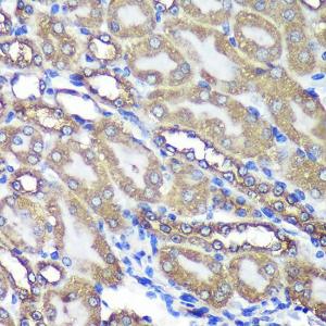 Immunohistochemistry analysis of paraffin-embedded mouse kidney using Anti-ANKLE2 Antibody (A305517) at a dilution of 1:100 (40x lens)