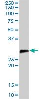 Anti-DCUN1D1 Rabbit Polyclonal Antibody